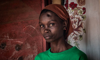 Guinée. Les victimes d’usage illégal de la force en attente de soins et de justice